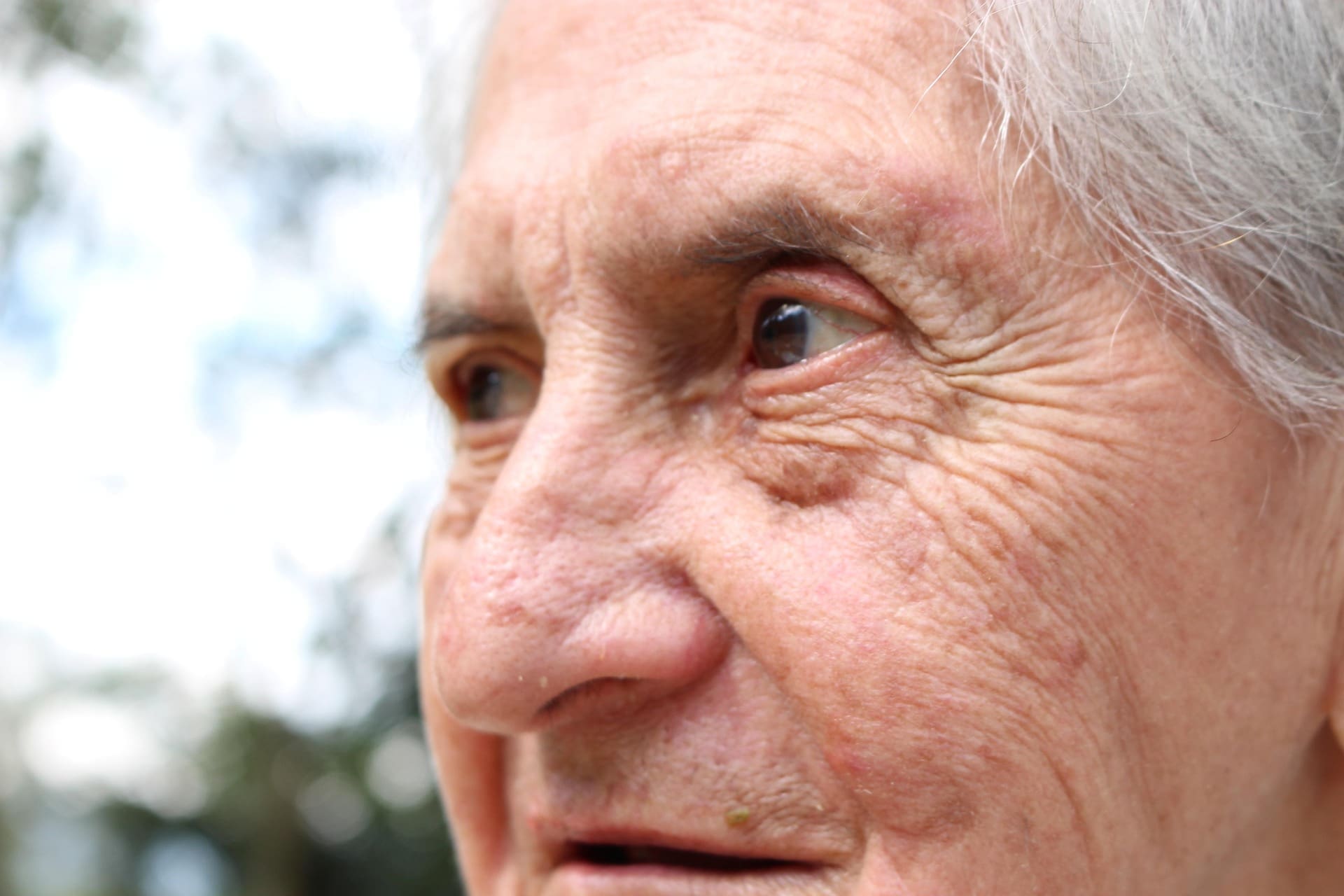 Dementia Live-In Care Edinburgh